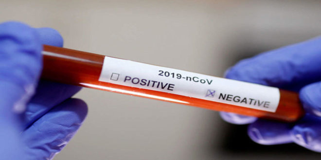 corona virus test negatif